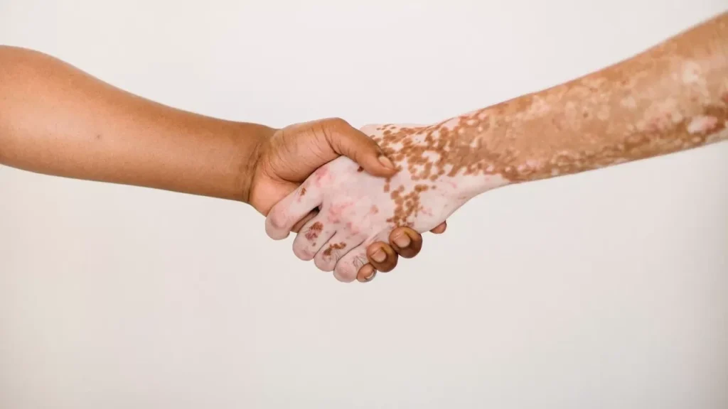 Close-up of a handshake between diverse hands with varying skin tones, symbolizing unity and acceptance.